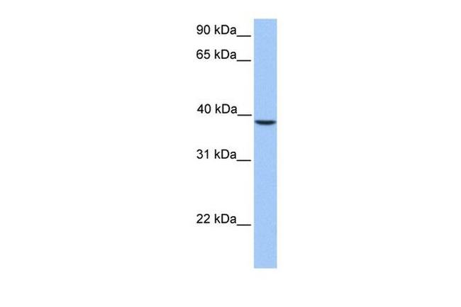 SUN3 Antibody in Western Blot (WB)