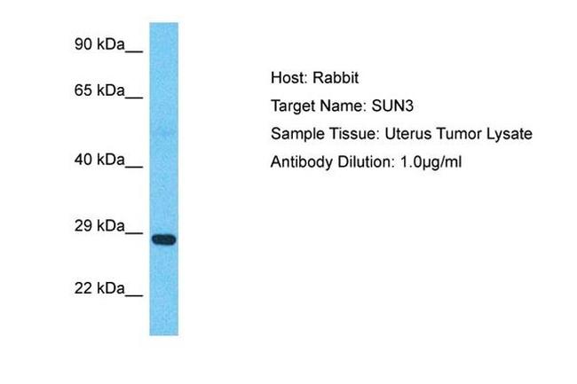 SUN3 Antibody in Western Blot (WB)