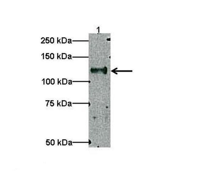 TRAK1 Antibody in Western Blot (WB)