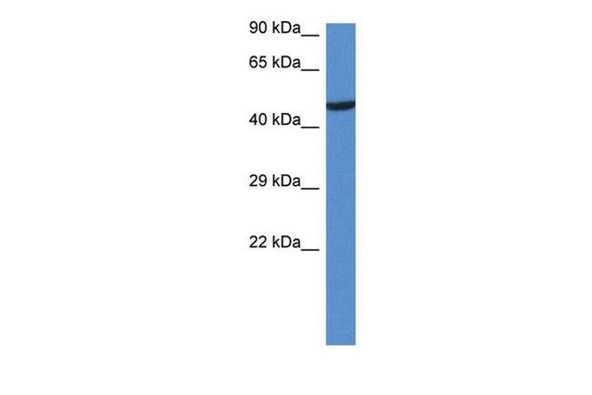 Lyn Antibody in Western Blot (WB)