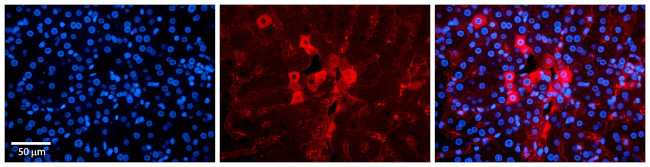 METL5 Antibody in Immunocytochemistry (ICC/IF)