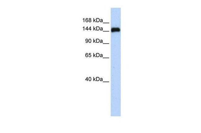 GSE1 Antibody in Western Blot (WB)