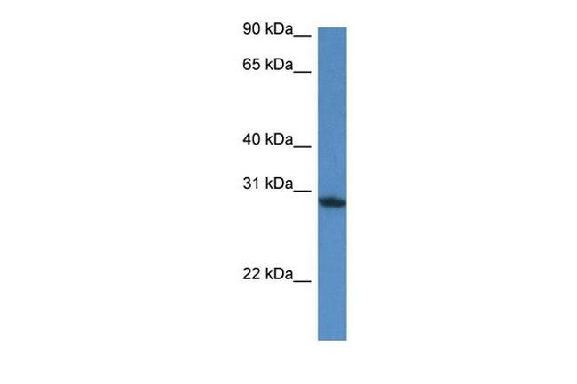 FAM168A Antibody in Western Blot (WB)