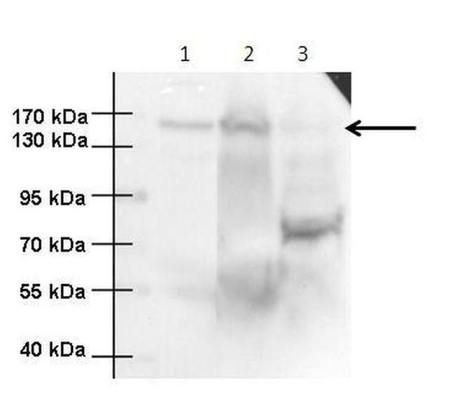 ANKS1 Antibody in Western Blot (WB)