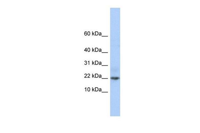 FAM219A Antibody in Western Blot (WB)