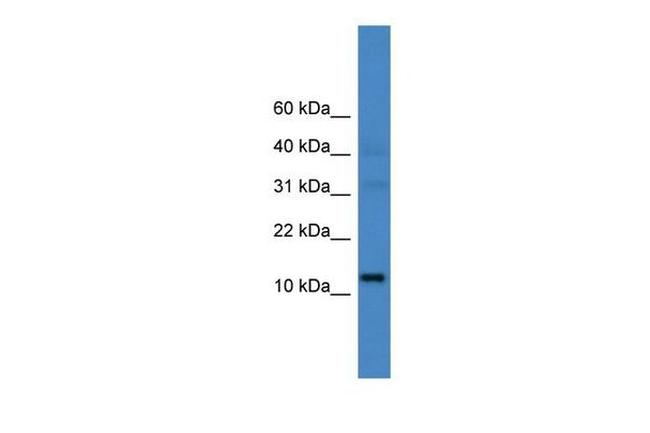 C14orf48 Antibody in Western Blot (WB)