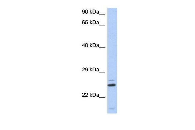 TTC9C Antibody in Western Blot (WB)
