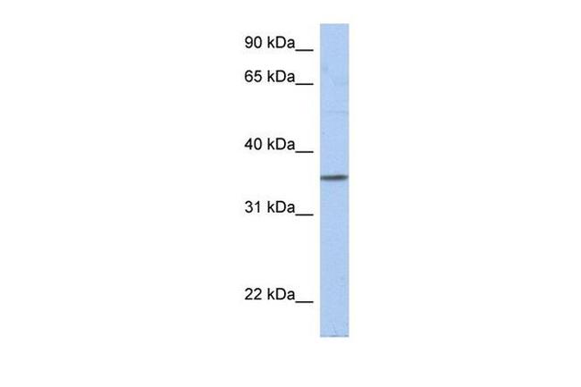 PRR18 Antibody in Western Blot (WB)
