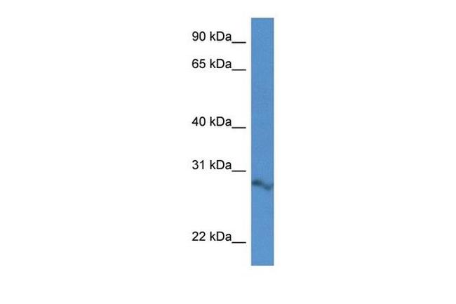 ARPIN Antibody in Western Blot (WB)