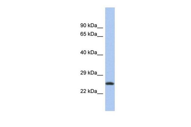 C9orf173 Antibody in Western Blot (WB)