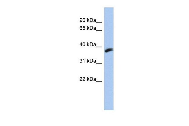 CYB5RL Antibody in Western Blot (WB)