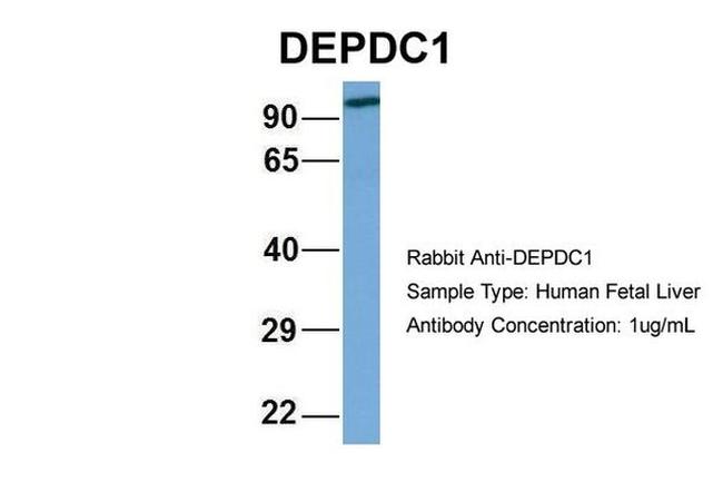 DEPDC1 Antibody in Western Blot (WB)