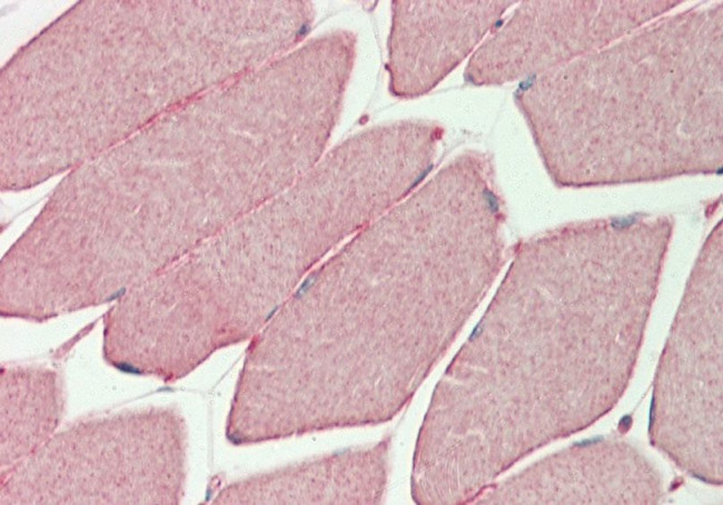 PHKG1 Antibody in Immunohistochemistry (Paraffin) (IHC (P))