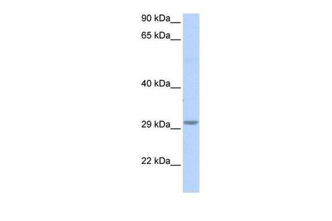ABHD17B Antibody in Western Blot (WB)