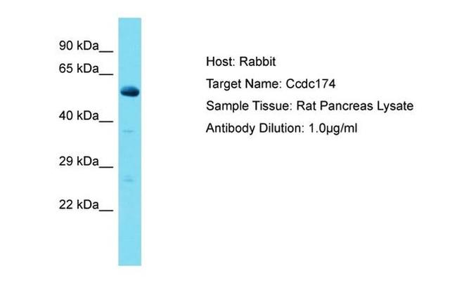CCDC174 Antibody in Western Blot (WB)