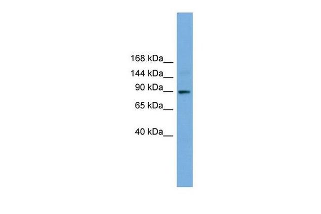 TTC27 Antibody in Western Blot (WB)