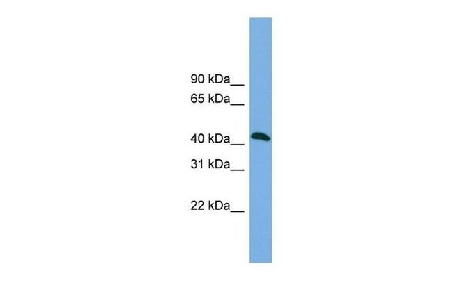 ANKMY2 Antibody in Western Blot (WB)