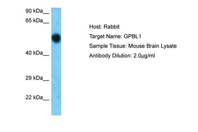 GPBP1L1 Antibody in Western Blot (WB)