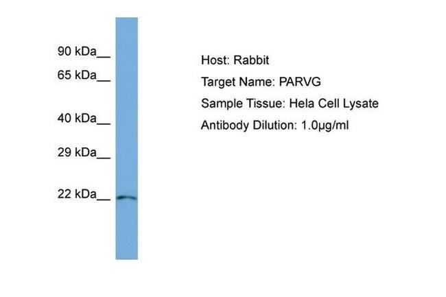 PARVG Antibody in Western Blot (WB)