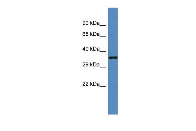 Gm5581 Antibody in Western Blot (WB)