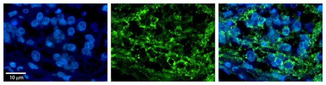 DLD Antibody in Immunohistochemistry (Paraffin) (IHC (P))