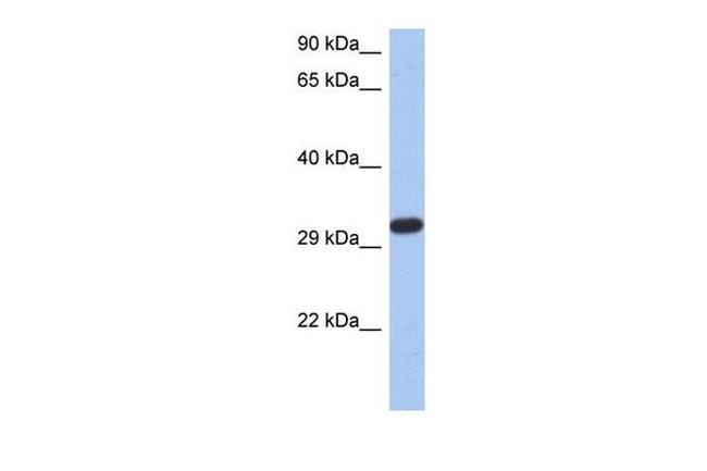 CAPZA3 Antibody in Western Blot (WB)