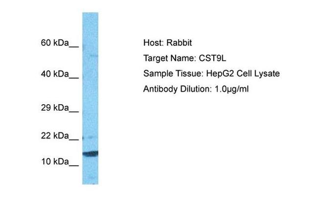 CST9L Antibody in Western Blot (WB)