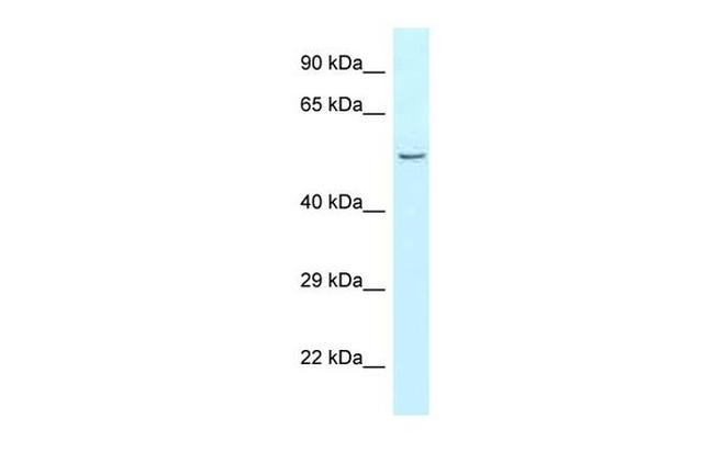 Carboxypeptidase A5 Antibody in Western Blot (WB)