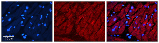 TIMP3 Antibody in Immunocytochemistry (ICC/IF)