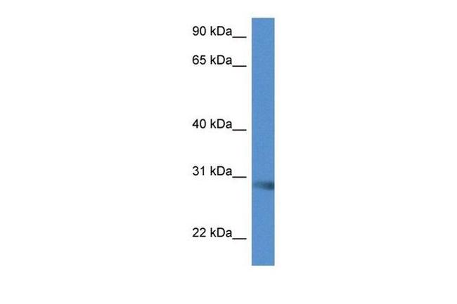 SCAMP5 Antibody in Western Blot (WB)