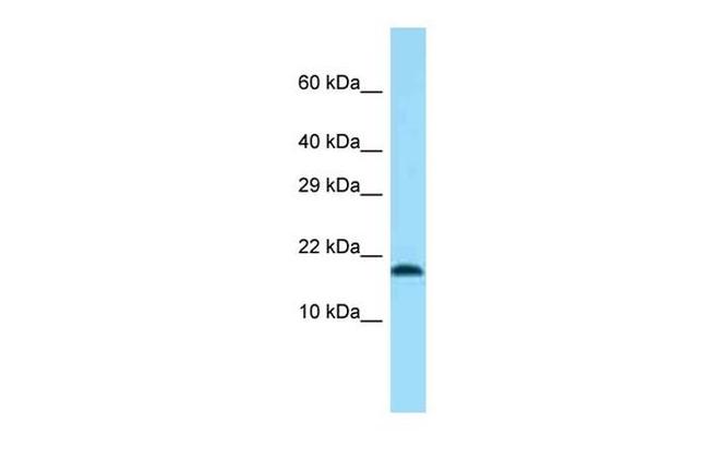 TMEM50B Antibody in Western Blot (WB)
