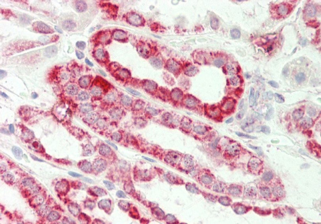 MGST3 Antibody in Immunohistochemistry (Paraffin) (IHC (P))