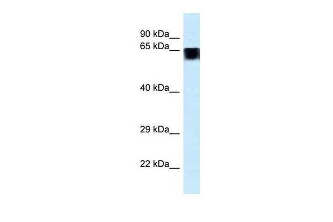 FAM161A Antibody in Western Blot (WB)