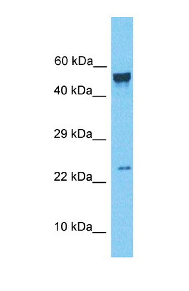 NAA38 Antibody in Western Blot (WB)