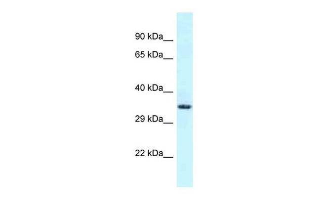 FSD1L Antibody in Western Blot (WB)