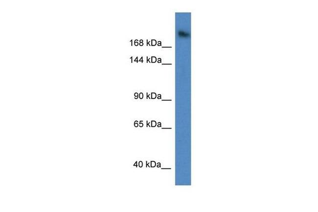 WDR87 Antibody in Western Blot (WB)