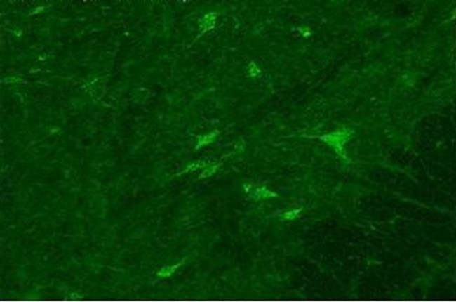 SPSB2 Antibody in Immunohistochemistry (IHC)