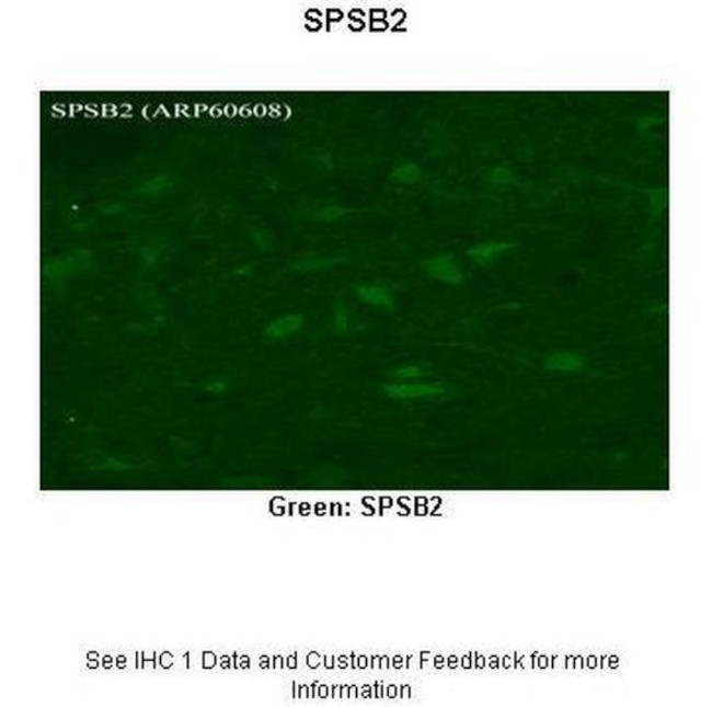 SPSB2 Antibody in Immunohistochemistry (IHC)