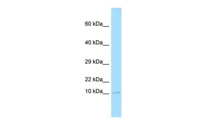 CKS1 Antibody in Western Blot (WB)