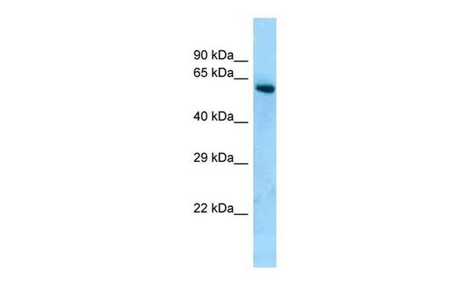 CTIF Antibody in Western Blot (WB)