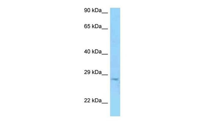 PRSS58 Antibody in Western Blot (WB)