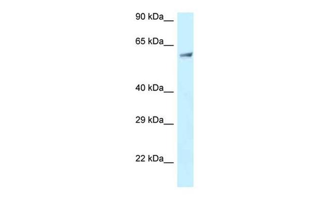 ENTH Antibody in Western Blot (WB)
