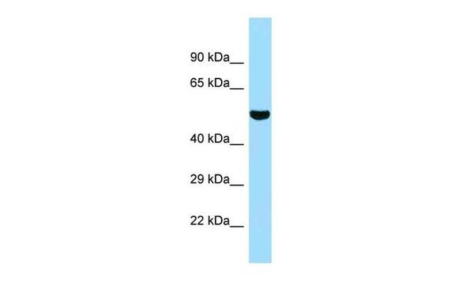 SUGCT Antibody in Western Blot (WB)