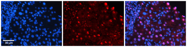 Moesin Antibody in Immunohistochemistry (IHC)