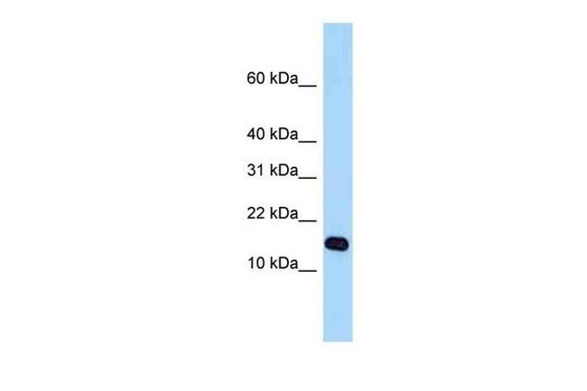 STH Antibody in Western Blot (WB)