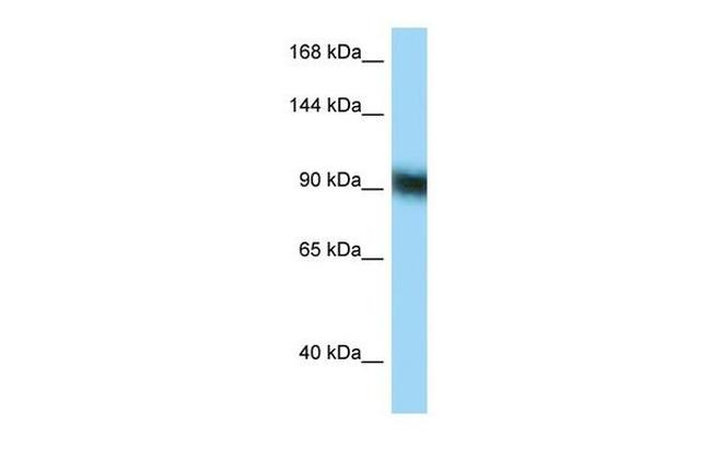 ZFP62 Antibody in Western Blot (WB)
