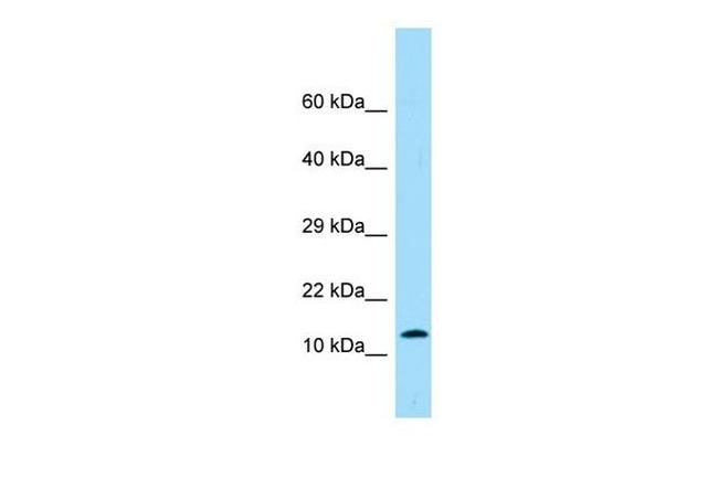 PROK2 Antibody in Western Blot (WB)
