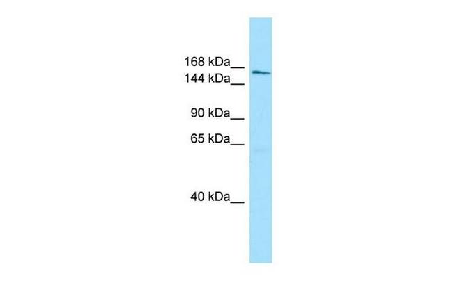 AQR Antibody in Western Blot (WB)