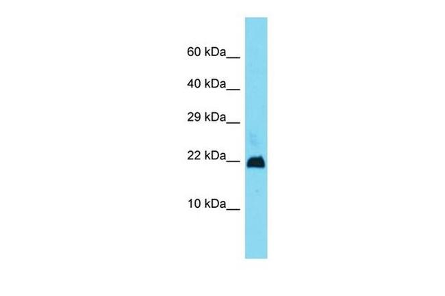 Gm11686 Antibody in Western Blot (WB)