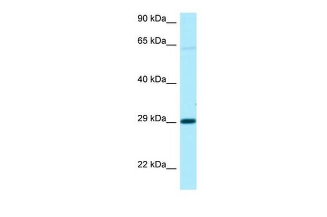 NIPA1 Antibody in Western Blot (WB)
